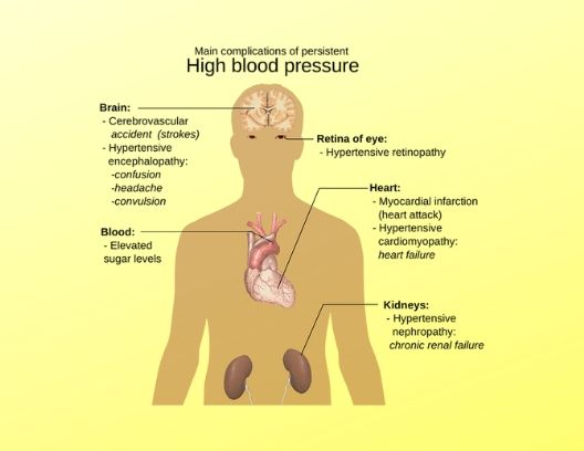 High Blood Pressure .. healthy-myself.com