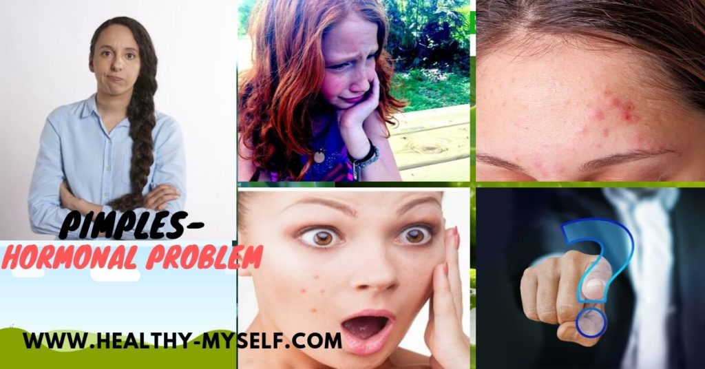 Pimples Cause/healthy-myself.com