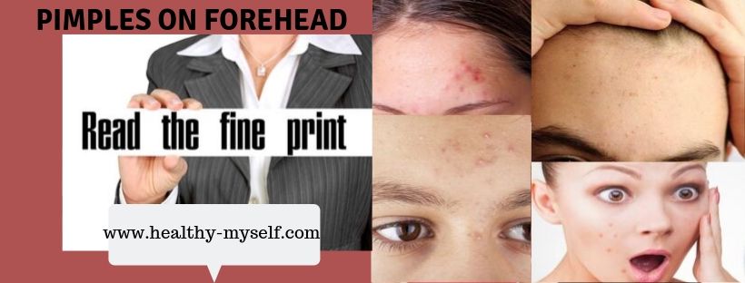 Pimples On Forehead