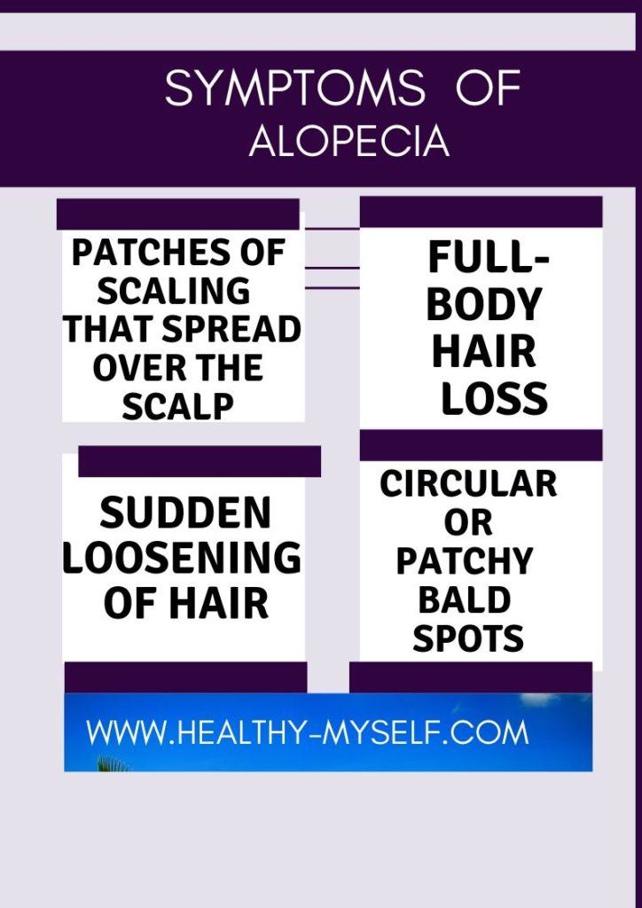 Symptoms Of Alopecia Areata... Healthy-myself.com
