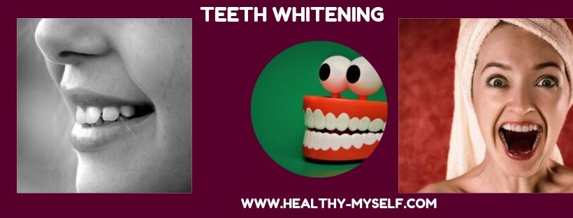 Teeth Whitening /healthy-myself.com