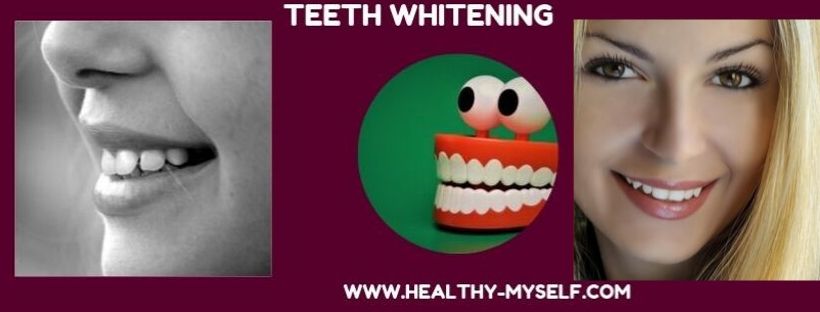 Teeth Whitening /Healthy-myself.com