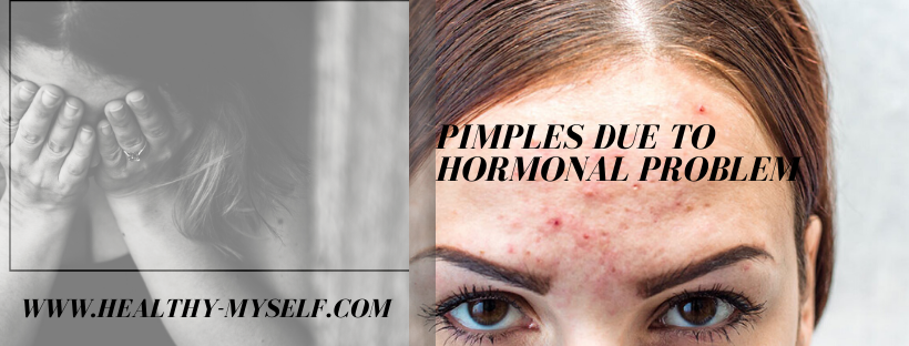 Pimples due to hormonal problem /healthy-myself.com