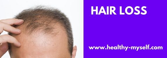 Hair loss /Healthy-myself.com